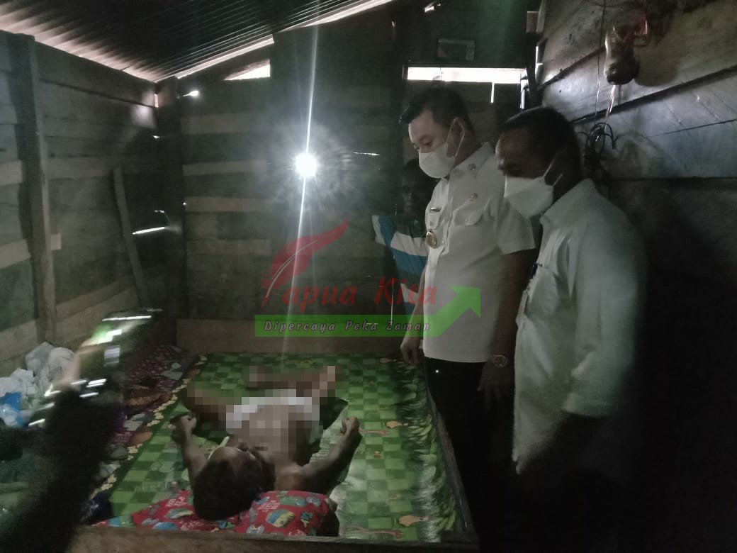 Bupati Kaimana Fredy Thie saat menjenguk mantan Kepala Kampung Manggera, Stevanus Nyai
