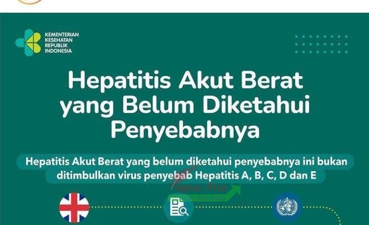 Informasi Hepatitis Akut Berat